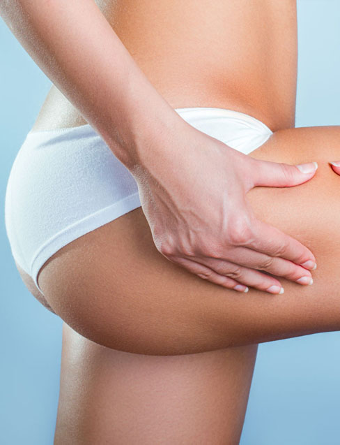 Bioestimulação de Colágeno Adicional